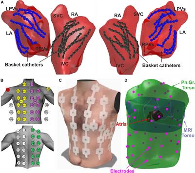 Non-invasive Spatial Mapping of Frequencies in Atrial Fibrillation: Correlation With Contact Mapping